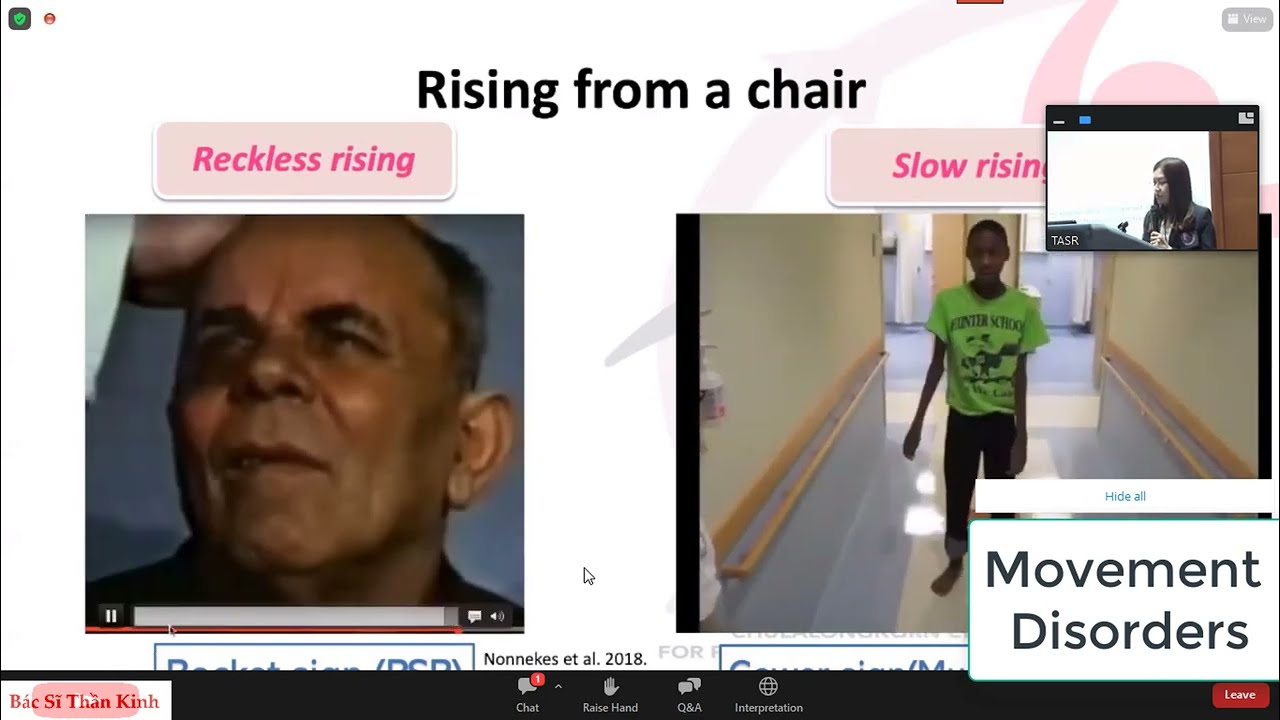 P3 - Gait Disorders (Indo-China Movement Disorders Conference 2022)