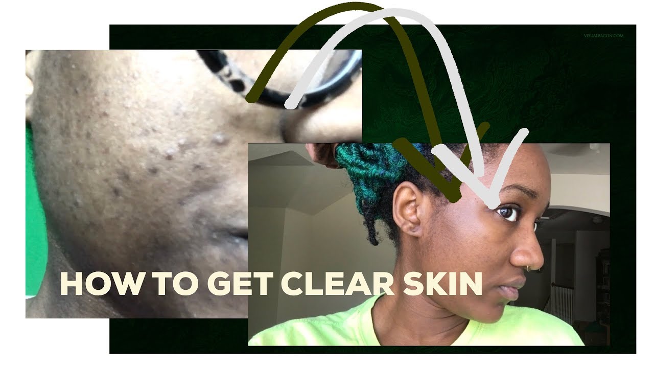 Journey to Clear Skin Skincare Routine 2017 YouTube