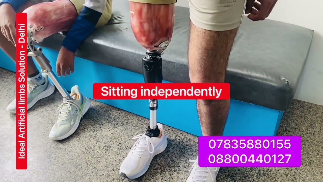 artificial limb07835880155Capital knee joint|HydraulicStance andswing phasecontrol|Ossur|collegepark