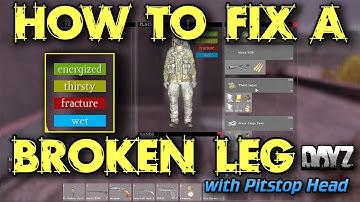 How to Fix a Broken Leg in DayZ Standalone