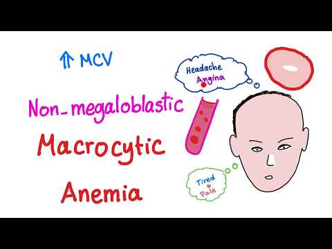 Non-megaloblastic Macrocytic Anemia