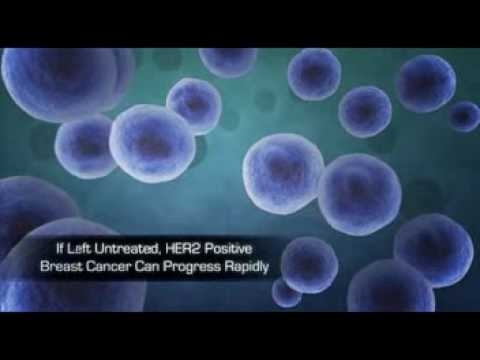 Herceptin: A Multimodal Approach Targeting HER2 Positive Breast Cancer