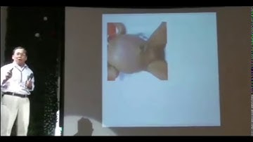 Siêu âm cấp cứu bụng ở trẻ em dưới 2 tuổi (Bs. Nguyễn Hữu Chí)