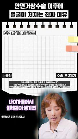 라봄성형외과✨확장이전 이벤트✨전수술30%할인❤ - YouTube 라봄성형외과✨확장이전 이벤트✨전수술30%할인❤ - Youtube