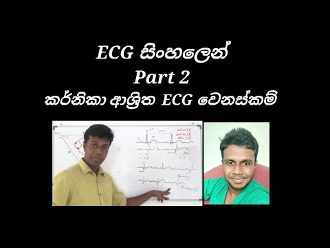 ECG- කියවමු 2 කොටස - හදවතේ කර්නිකා ආශ්‍රිතව ඇතිවන ECG වෙනස්කම් - Heart block ,  fibrillation ,  WPW