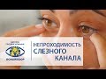 Азнаурян И.Э. Непроходимость слезного канала