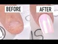 How To Fix Short Bitten Nails with Gel - Nails 21