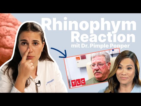 Video: Wie behandelt man Rhinophym natürlich?