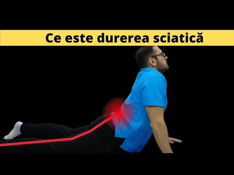 Video: Durerea de sciatică ar putea fi cancer?