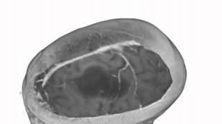 High-Quality Multimodal Volume Rendering for Preoperative Planning of Neurosurgical Interventions