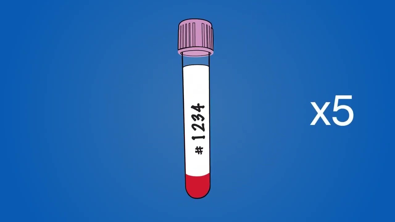 idexx vetautoread アイデックスvettubes120本 Buy IDEXX VetAutoread
