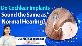 Hi9 | Do Cochlear Implants sound the same as normal Hearing Dr. Shree Cuddapah Rao | ENT Surgeon