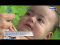 Адиля Сабирова, 7 месяцев, синдром короткой кишки