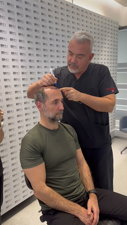 Shots from the hair transplant operation of Semih Saygıner who is the legend of billiard #asmed