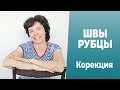 Швы и рубцы. Самостоятельная коррекция