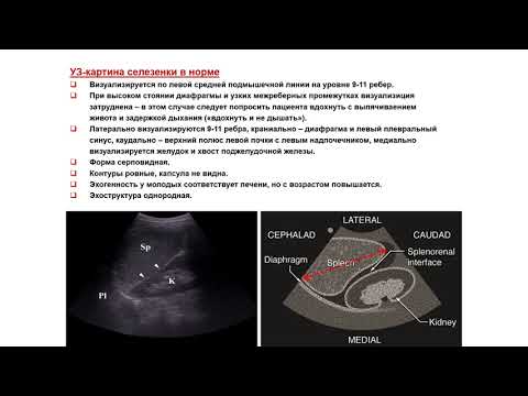 Ультразвуковая диагностика (УЗИ). Доктор Иогансен. Выпуск 59. Методика УЗИ селезенки.