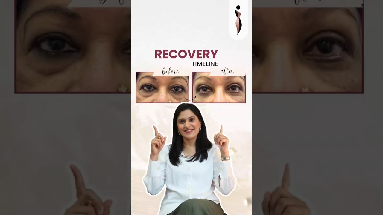 How to Recover from #Blepharoplasty | Plastic Surgeon’s Guidance on #EyelidSurgery Recovery