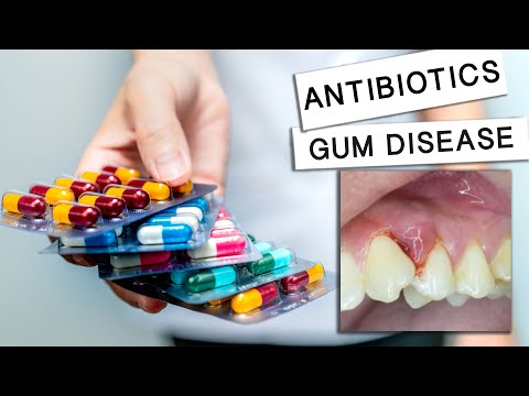Can Antibiotics Cure Gum Disease?