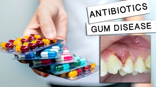 Can Antibiotics Cure Gum Disease?