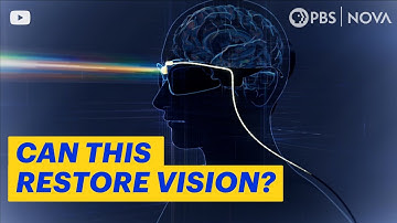 How Brain Implants Are Simulating Vision for the Blind | NOVA | PBS