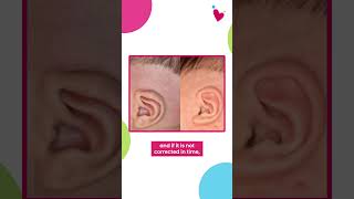 Understanding Infant Ear Deformities