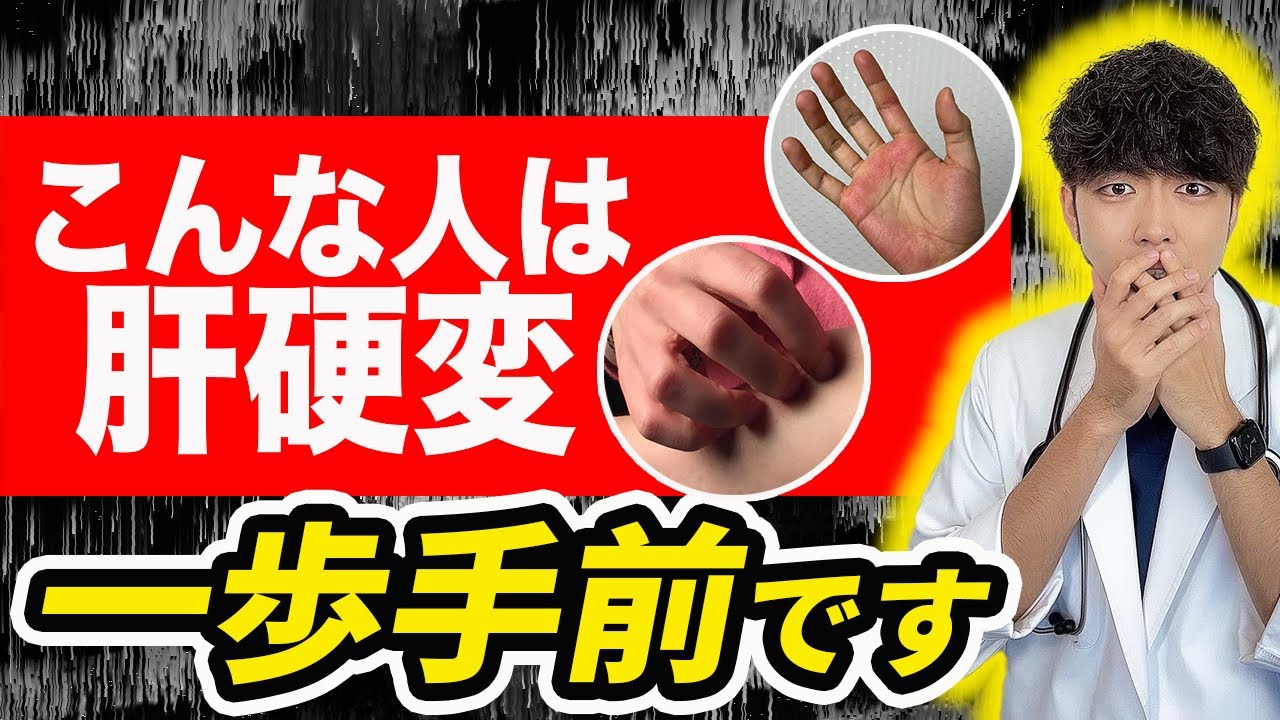 【危険】肝臓が壊れる寸前のSOSサイン‼︎ 肝臓を回復させる方法とは？【脂肪肝/肝硬変】現役医師が食事法を解説