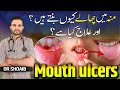 How To Treat Mouth Ulcers And Prevent Them In Urdu म ह क छ ल How To Treat Mouth Ulcers And Prevent Them In Urdu म ह क छ ल