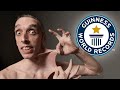 The Stretchiest Skin In The World - Guinness World Records