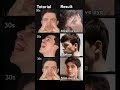 Neet UG Students MCQ Questions And Answers Bsc Nursing#youtubeshorts #ytshorts #shortvideo #shorts