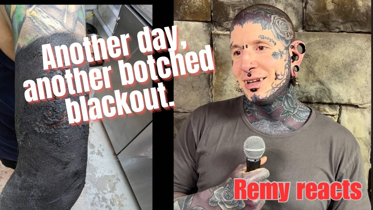 Remy reacts to Blackout Fails #10