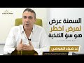 السمنة عرض لمرض اخطر هو سؤ التغذية