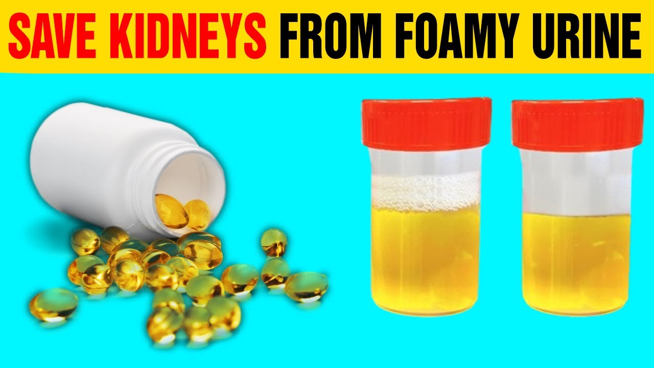 Top 5 Vitamins That Help Stop Proteinuria and Heal Your Kidneys | Green Lifestyle