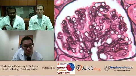 Web Episode #002 - Renal Pathology Teaching Series (Dr. Gaut and Dr. Rajan)