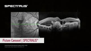 🇺🇸 Picture Carousel Animation | SPECTRALIS®