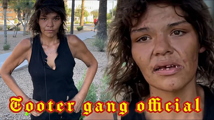 Gladys 28 disabled, homeless and addicted