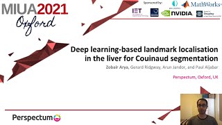 MIUA2021: Deep Learning-Based Landmark Localisation in the Liver for Couinaud Segmentation
