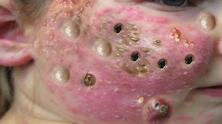 𝑨𝒄𝒉𝒊𝒆𝒗𝒆 𝑰𝒏𝒏𝒆𝒓 𝑷𝒆𝒂𝒄𝒆 𝑾𝒊𝒕𝒉 𝑻𝒉𝒆𝒔𝒆 𝑭𝒂𝒄𝒊𝒂𝒍 𝑪𝒍𝒆𝒂𝒏𝒔𝒊𝒏𝒈 𝑴𝒆𝒕𝒉𝒐𝒅𝒔 #964721