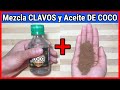 Esto esta haciendo maravillas y las mujeres no dejan de prepararlo ¡Clavos y aceite de coco!