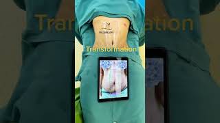 A bespoke mommy make over done by Dr. Alex Trinh Long