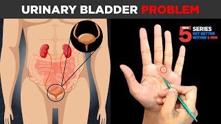 SUJOK TREATMENT FOR Urinary Bladder Problem😖🔥(ON LEFT HAND) screenshot 4