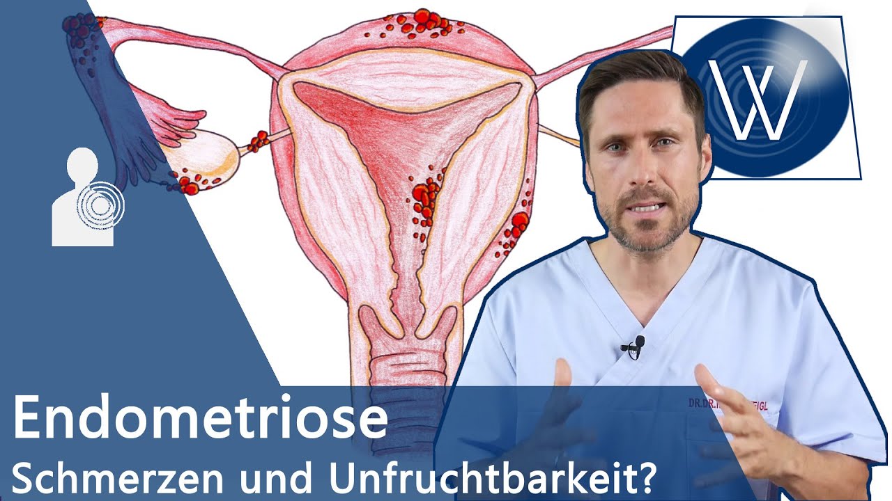 Endometriose: Symptome, Diagnose und die richtige Behandlung | ARD Gesund