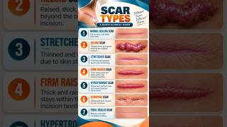 7 Types of Scars You Should Know 🩹 | Keloid vs Hypertrophic vs Atrophic#Shorts#skin#skincare#medical