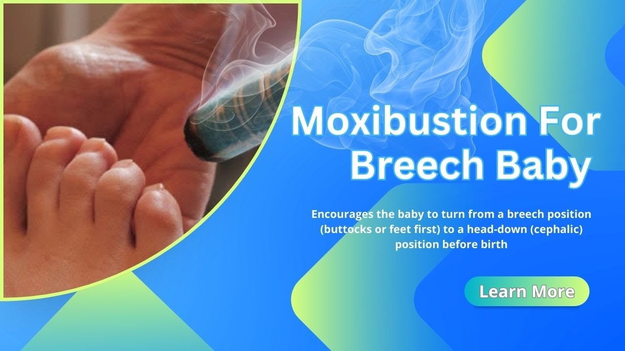 Breech Baby Help with Acupuncture Atlanta Experts