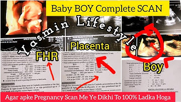 My Complete PREGNANCY Scan ll Baby BOY Scan ll Baby Boy Symptoms #anomalyscan