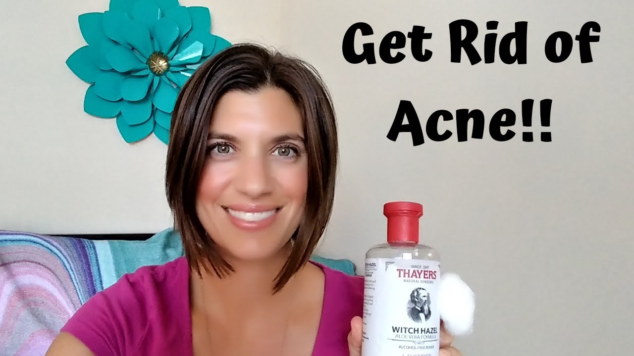 How I Finally Got Rid of Acne (including Cystic Acne) - YouTube