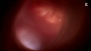 Life Before Birth In the Womb (Censored)