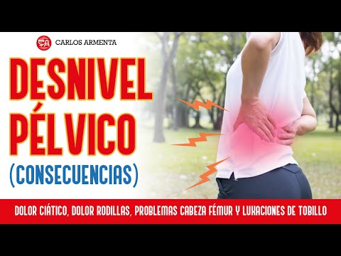 Video: ¿Qué es la desnivelación pélvica?