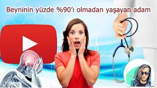 Beyninin %90 olmadan yaşayan adam