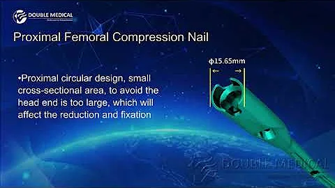 Proximal Femoral Compression Nail