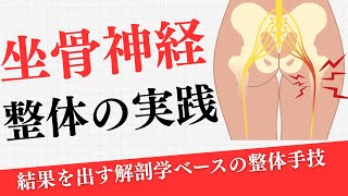 Sciatica] Immediate results! Demonstration of sciatic nerve